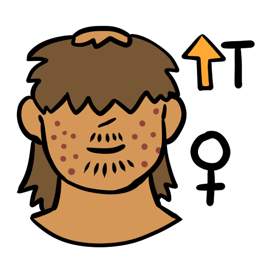 a person with light skin tone. They have acne, facial hair, and a bald spot on the top of their head. They have medium brown hair. In the upper left of the image is an orange up arrow next to the letter T. In the bottom left is a female symbol.